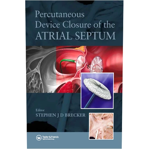 By Stephen Brecker (Editor) Format: Kindle Edition Percutaneous Device Closure of the Atrial Septum