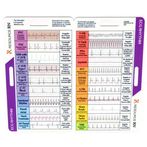 Resource RN EKG Rhythm Interpretation - Compact & Portable Reference Card – Rapid Interpretation Guide – Dual Horizontal & Vertical Layout