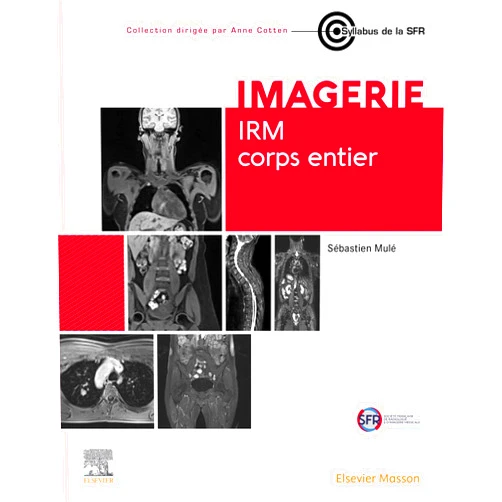 French Edition by Sébastien Mulé (Author), Hervé Brisse (Contributor), Liesbeth Cardoen (Contributor), Frédéric Lecouvet (Contributor), Alain Luciani (Contributor), François Chalard (Contributor), Edouard Reizine (Contributor), Mario Ghosn (Contributor), Douglas Lacomblez (Contributor), Paul Blanc-Durand (Contributor), Frédéric Pigneur (Contributor), Victoria Assouline (Contributor), Lina El Bejjani (Contributor), Emmanuel Itti (Contributor), Valentin RENAULT (Contributor), Laurence Baranes (Contributor), Rym Kharrat (Contributor), Solène Le Cam (Contributor), Vassiliki Pasoglou (Contributor), Annaelle Chetrit (Contributor), Nayla NICOLAS (Contributor), Nadia Venturelli (Contributor), Mathilde Vermersch (Contributor), Robert Carlier (Contributor), Mickael Tordjman (Contributor), Inès Mannes (Contributor), Athena Galletto Pregliasco (Contributor), Antoine Feydy (Contributor), Marjan Djabbari (Contributor), Amine Ammar (Contributor) & 27 more Format: Kindle Edition IRM corps entier (French Edition)