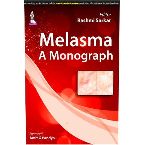 Rashmi Sarkar Melasma: A Monograph