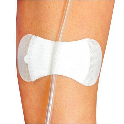 TIDI 3300M-10PK Grip-Lok Medium Securement Device ― Pack of 10 ― Catheter Stabilization Device ― White ― Low-Profile Design for Comfort― Home Healthcare ― FSA Eligible Medical Supplies