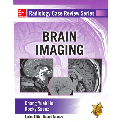 By Chang Ho (Author), Rocky Saenz (Author) Format: Kindle Edition Radiology Case Review Series: Brain Imaging