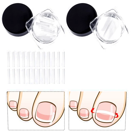 Maitys 60 Pieces Ingrown Toenail Corrector Strips Ingrown Toenail Correction Brace Toenail Correction Clip Toenail Straightening Recover Patch Curved Toenail Corrector for Women Men Foot Care, 2 Styles