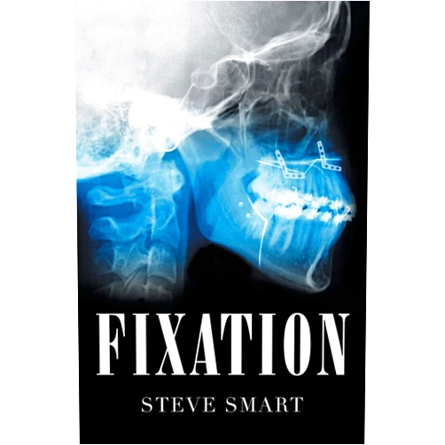 Steve Smart Fixation