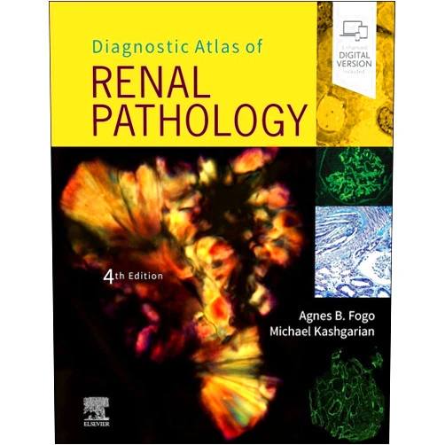 By Agnes B. Fogo MD (Author), Michael Kashgarian MD (Author) Diagnostic Atlas of Renal Pathology