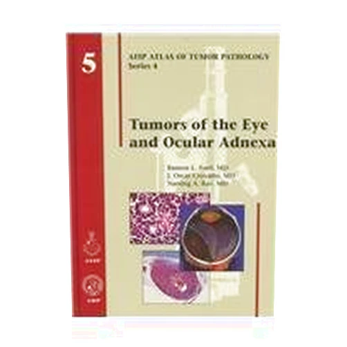 By Ramon L. M.D. Font (Author) Tumors of the Eye and Ocular Adnexa (Afip Atlas of Tumor Pathology) 1st edition by Font, Ramon L., M.D., Croxatto, J. Oscar, M.D., Rao, Narsing (2006) Hardcover