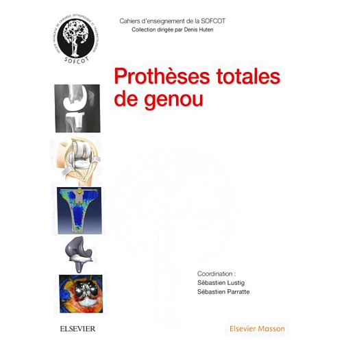French Edition by Sébastien Lustig (Author), Sébastien Parratte (Author) Format: Kindle Edition Prothèses totales de genou (Cahiers d'enseignement de la SOFCOT) (French Edition)