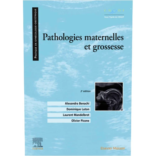 French Edition by Alexandra Benachi (Author), Dominique Luton (Author), Laurent Mandelbrot (Author), Olivier Picone (Author), Camille Le Ray (Contributor), Djillali Annane (Contributor), Gaëlle Guettrot-Imbert (Contributor), Norbert Winer (Contributor), Julia Filippova (Contributor), Renato Fior (Contributor), Sophie Chauvet (Contributor), Simon Msika (Contributor), Sandra de Miranda (Contributor), Valentin Keller (Contributor), Morgane VALENTIN (Contributor), Robert Girot (Contributor), Rakiba Belkhir (Contributor), Lynda Bererhi (Contributor), Sophie Cordiez (Contributor), Denis Gallot (Contributor), Dominique Grenet (Contributor), Laura Polivka (Contributor), Géraud Tuyeras (Contributor), Eric Verspyck (Contributor), Hélène Legardeur (Contributor), Hélène Affres (Contributor), Sophie Matheron (Contributor), Magalie Ladouceur (Contributor), Elisabeth Bouvet (Contributor), Claire Bonneau (Contributor), Amandine Maulard (Contributor), Thomas Ronzière (Contributor), Hervé Fernandez (Contributor), Sarak Tebeka (Contributor), Isabelle MARIE (Contributor), Sarah Cohen (Contributor), Bertrand Godeau (Contributor), Marc Dommergues (Contributor), Marie Bornes (Contributor), Bérangère Joly (Contributor), Marc Humbert (Contributor), Lise Selleret (Contributor), Léopoldine Bricaire-Dubreuil (Contributor), David Vandendriessche (Contributor), Chloé Comarmond-Ortoli (Contributor), Elizabeth Elefant (Contributor), Philippe Chanson (Contributor), Jacqueline Conard (Contributor), Véronique Le Guern (Contributor), Yoram Bouhnik (Contributor), Nathalie Trillot (Contributor), Bernard Clair (Contributor), Edith Peynaud-Debayle (Contributor), Jacky Nizard (Contributor), Marie Houllier (Contributor), Frédéric Galacteros (Contributor), Ngoc Tram TÔ (Contributor), Maela Le lous (Contributor), Pascale Amate (Contributor), Valérie Roussel-Robert (Contributor), Anna Molto (Contributor), Elodie Clouqueur (Contributor), Roxane Vanspranghels Gibert (Contributor), Stéphanie Guillet (Contributor), Lucia Rugeri (Contributor), Gilles Kayem (Contributor), Sarah Coscas (Contributor), Véronique Houfflin-Debarge (Contributor), Rana Aoun (Contributor), Claude Lejeune (Contributor), Roman Rouzier (Contributor), Nadia Merbai (Contributor), Clément Picard (Contributor), Caroline Dubertret (Contributor), Laurence Amar (Contributor), Emmanuelle De Raucourt (Contributor), Elie Azria (Contributor), Florence Bretelle (Contributor), Lionel GROUSSIN ROUILLER (Contributor), Jean-Antoine Ribeil (Contributor), David Saadoun (Contributor), Lise Duranteau (Contributor), Pierre Sellier (Contributor), Corinne Bouteloup (Contributor), Franck Perrotin (Contributor), Gilles Garcia (Contributor), Julie Carrara Carrara (Contributor), Smail Hadj-Rabia (Contributor), Claire Le Jeunne (Contributor), Aude Rossi (Contributor), Jean-Emmanuel Kahn (Contributor), Anoosha Habibi (Contributor), Grégoire Martin De Frémont (Contributor), Camille Taillé (Contributor), Damien Subtil (Contributor), Philippe Deruelle (Contributor), Emile Daraï (Contributor), Sophie Nebout (Contributor), Violaine Ozenne (Contributor), Brigitte Perrouin-Verbe (Contributor), Mathieu Uzzan (Contributor), Bertrand Wechsler (Contributor), Sandra Vukusic (Contributor), Henri-Jean PHILIPPE (Contributor), Jacques Bernuau (Contributor), Marie-Victoire Senat (Contributor), Vassilis Tsatsaris (Contributor), Nathalie Costedoat-Chalumeau (Contributor), Cécile Lavenu-Bombled (Contributor), Roseline d’Oiron (Contributor), Benedicte Dumont (Contributor), Sandrine Perol (Contributor), Dominique Bremond-Gignac (Contributor), Pierre-François Ceccaldi (Contributor), Arnaud Bresset (Contributor), Anne-Sophie Ducloy-Bouthors (Contributor), Bernard IUNG (Contributor), Marie Bruyère (Contributor), Geneviève Plu-Bureau (Contributor), Ivan Berlin (Contributor), Diane Friedman (Contributor), Jacques-François Young (Contributor), Amélie Delabaere (Contributor), Xavier Jaïs (Contributor), Gilles Grangé (Contributor), Lucile Houyel (Contributor), Violaine Peyronnet Peyronnet (Contributor), Jean-Yves Gauvrit (Contributor), Anne-Gaël Cordier (Contributor), Sophie Conquy (Contributor), Nejla ESSAFI (Contributor), Guillaume Jondeau (Contributor), Hawa KEÏTA MEYER (Contributor), Emmanuel Messas (Contributor), Anne Gervais (Contributor), Jean-Baptiste De Fréminville (Contributor), Emmanuel Boleslawski (Contributor), Stéphanie Morgant (Contributor), Aurélie VINCENT (Contributor), Olivier Hermine (Contributor), Raphaële Seror (Contributor), Bertrand de Toffol (Contributor), Gabriel Perlemuter (Contributor), Nadine Ajzenberg (Contributor), Henri Copin (Contributor), Hubert Ducou Le Pointe (Contributor), Laurence Iserin (Contributor), Michael FRANK (Contributor), Denis Therby (Contributor), Aurélien Lorthioir (Contributor) & 146 more Format: Kindle Edition Pathologies maternelles et grossesse (French Edition)