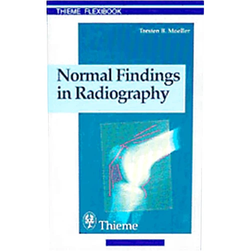 Torsten Bert Moeller Normal Findings in Radiography (Thieme Flexibook)