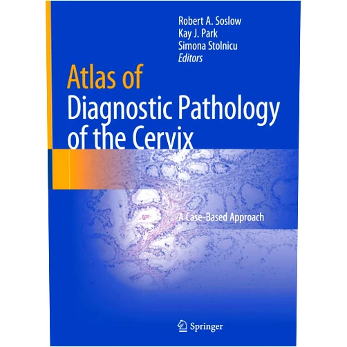 Robert A. Soslow,Kay J. Park,Simona Stolnicu Atlas of Diagnostic Pathology of the Cervix: A Case-Based Approach