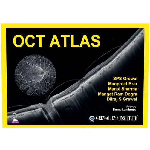 By SPS Grewal (Author), Manpreet Brar (Author), Mansi Sharma (Author), Mangat Ram Dogra (Author), Dilraj S Grewal (Author) & 1 more Format: Kindle Edition OCT Atlas