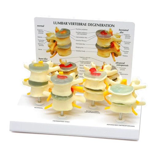 GPI Anatomicals - 4-Stage Vertebrae Model, Spine Model for Human Anatomy and Physiology Education, Anatomy Model for Doctor's Office and Classrooms, Medical Learning Resources