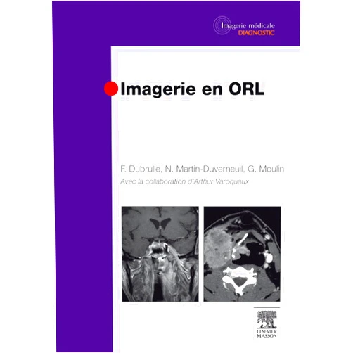 Frédérique Dubrulle,Nadine Martin-Duverneuil,Guy Moulin,Arthur Varoquaux,Catherine Alaeddine-Lejalle,Christopher Bourdet,Brigitte Bourlière,Hervé Brunel,Pierre Cassagneau,Delphine Caudal,Christophe Chagnaud,Pierre Champsaur,Frédérique Chapon,Jean-Baptiste Charrier,Dominique Chevalier,Mélika Amor-Sahli,Frédéric Clarençon,Frédéric Cohen,Fabien Craighero,Arnaud DEVEZE,Florian Desmot,Philippe Dory-Lautrec,Aurélie Drier,Aïda EL AMRI,David Facon,Jean-Claude Ferrié,Farida BENOUDIBA,Loïc Gaillandre,Jean-Christophe Gentric,Nadine Girard,Daphné Guenoun,Alexis Jacquier,Jean-Michel Klossek,Guillaume LOUIS,Jean-Pierre Lavieille,Marine Lefèvre,Cyril MULLER,Mokran BOUKHELIFA,Jacques Paul Magnan,Sandrine Marciano-Chagnaud,Claude Marsault,Philippe Meriot,Olivier Monnet,Sophie Périé,Gilles Piana,Jean-Daniel Piekarski,Géraldine Placko-Parola,Pascale SILES,Axelle Bailhache,Raphaëlle Souillard-Scemama,Marc Tassart,Jean-Marc Thomassin,Vincent VIDAL,Emilie Wikberg-Lafont,Marc Williams,Jean-Michel Bartoli,Raphaël Blanc,Florence Boccara-Rodriguez,Fabrice Bonneville Imagerie en ORL (French Edition)