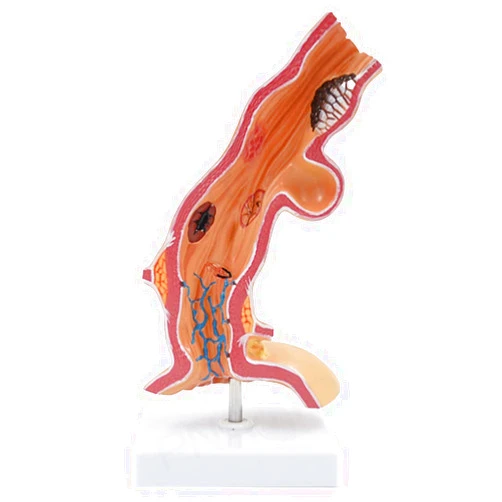 MDNZZ Removerable Esophageal Anatomy Model Esophagus Digestive System Model Departmental Medical Teaching Human Organ Anatomy Model for Teaching Anatomy