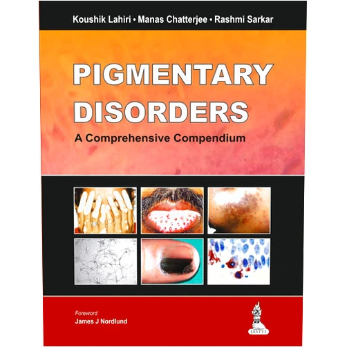Koushik Lahiri,Manas Chatterjee,Rashmi Sarkar Pigmentary Disorders: A Comprehensive Compendium