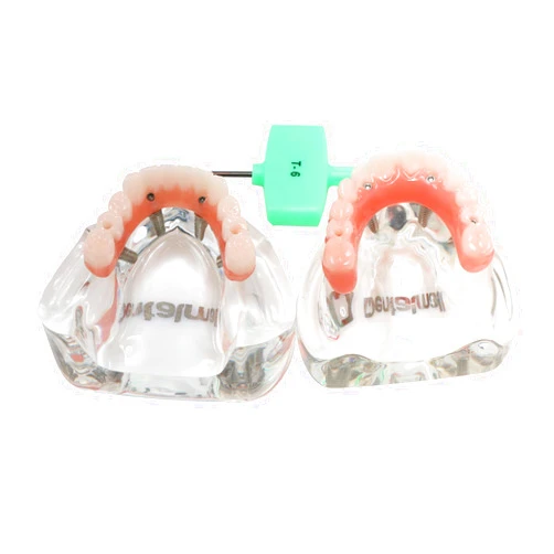 Ningfan Dental Implant Model,Implant Malian Bridge/Overdenture All on 4 Treatment Demo Model,Upper/Lower Jaw with 4 Implants Kit, Study Explaining Tools (M6001-1+6027-60 Kit (U/L-4))
