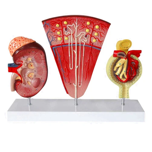 HaqUos Human Anatomy Science Models,Human Kidney Anatomical Model, Teaching Model,Nephron Glomerulus Anatomy Medical Study Kits