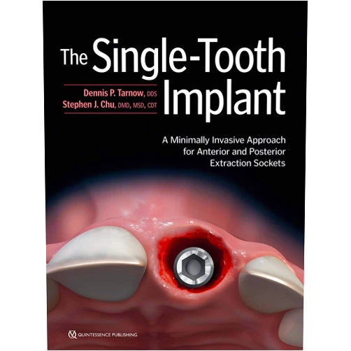 Dennis P. Tarnow,Stephen J. Chu The Single-Tooth Implant: A Minimally Invasive Approach for Anterior and Posterior Extraction Sockets