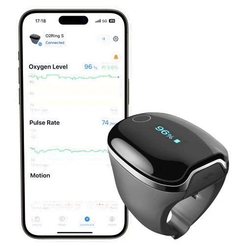 Wellue O2Ring-S Oxygen Monitor with Vibration Reminder, Bluetooth Pulse Oximeter Tracks SPO2 and Pulse Rate, 24 hrs Battery Life, 4*10 Hours Built-in Memory, Rechargeable Pulse Ox with Free PC & APP