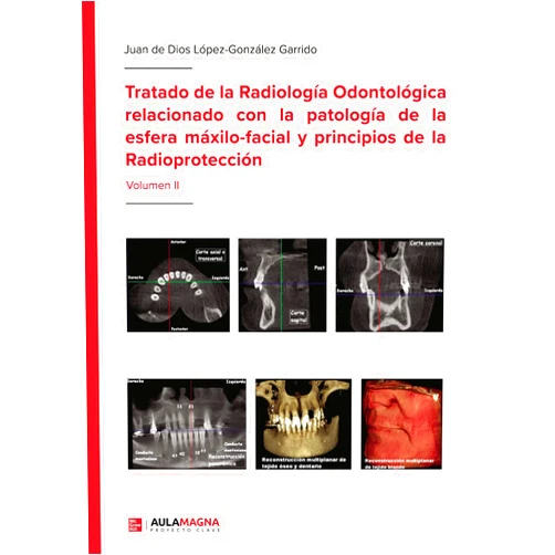 Spanish Edition by Juan de Dios López-González Garrido (Author) Format: Kindle Edition Tratado de la Radiología Odontológica relacionado con la patología de la esfera máxilo-facial y principios de la Radioprotección: Volumen II (Spanish Edition)