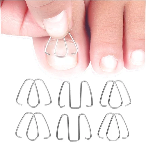 YUYTE Ingrown Toenail Wire Corrector Correction Lifter Tool Brace for Nail Toe Straighteners Braces Set for Pedicure Foot Care Men Women