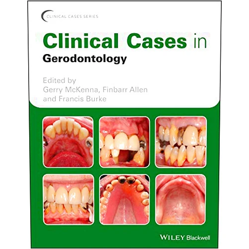 By Gerry McKenna (Editor), Finbarr Allen (Editor), Francis Burke (Editor) & 0 more Format: Kindle Edition Clinical Cases in Gerodontology (Clinical Cases (Dentistry))