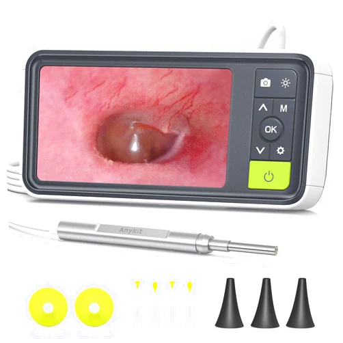 Anykit Digital Otoscope with Gyroscope, 4.5 Inches Screen, 3.9mm Ear Scope Camera with 6 Lights, Ear Wax Removal Tool, 32GB Card, Supports Photo Snap and Video Recording