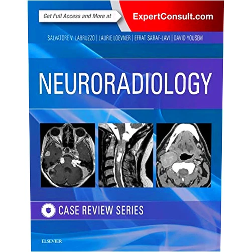 By Salvatore V. Labruzzo DO (Author), Laurie A. Loevner MD (Author), Efrat Saraf-Lavi MD (Author), David M. Yousem MD MBA (Author) & 1 more Neuroradiology Imaging Case Review