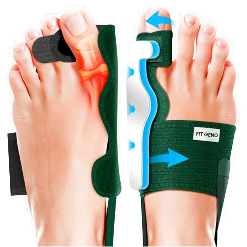 Fit Geno Bunion Corrector for Women & Men: Upgraded Bunion Splint, Adjustable & Breathable Big Toe Straightener for Day/Night, Non-Surgical Hallux Valgus Correction for Pain Relief (2 Pcs)