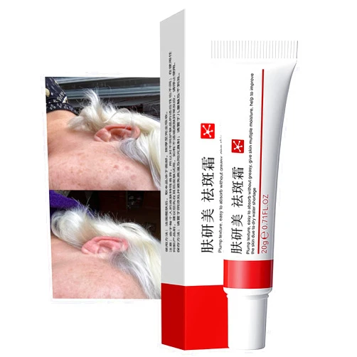Generic Crema para Manchas Oscuras en La Cara, Dark Spot Remover for Face, Freckles Melasma Brown Spot Corrector for Men Women, Crema para Las Manchas de La Cara 20G