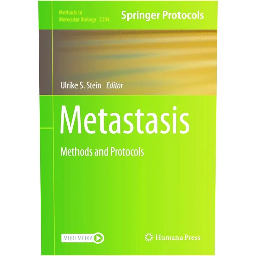 Ulrike S. Stein Metastasis: Methods and Protocols (Methods in Molecular Biology, 2294)