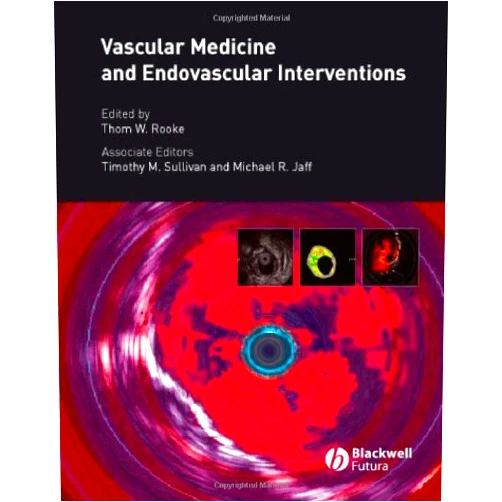 Thom W. Rooke Vascular Medicine and Endovascular Interventions