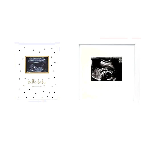Pearhead Cherished Baby Keepsake Bundle - Memory Book & Sonogram Frame