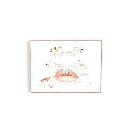 Custom Lip Filler Print, Lip Augmentation, Derma Filler Print, Plastic Surgeon Poster, Esthetic Surgery, Dermatologist Poster, Cosmetic Surgery Print,238