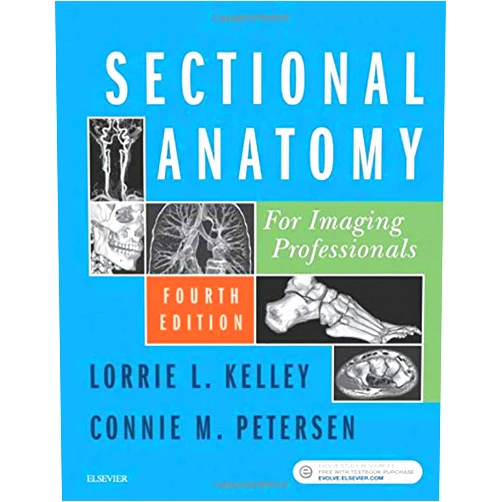 Lorrie L. Kelley MS RT(R),Connie Petersen MS RT(R) Sectional Anatomy for Imaging Professionals