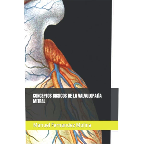 Dr Manuel Fernandez Molina,Dr. Christian Ortega Loubon,Dra. Cristina Sánchez Torralvo,Dr. Eduardo Velasco Garcia CONCEPTOS BASICOS DE LA VALVULOPATÍA MITRAL (Spanish Edition)