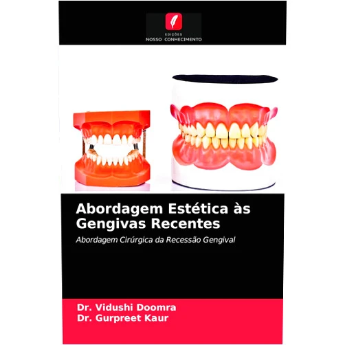 Dr. Vidushi Doomra,Dr. GURPREET KAUR Abordagem Estética às Gengivas Recentes: Abordagem Cirúrgica da Recessão Gengival (Portuguese Edition)