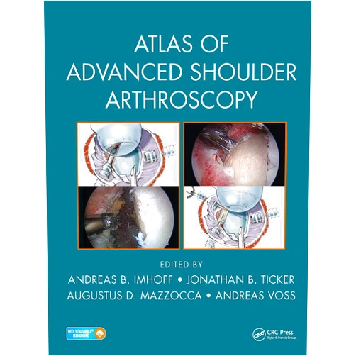Andreas B. Imhoff,Jonathan B. Ticker,Augustus D. Mazzocca,Andreas Voss Atlas of Advanced Shoulder Arthroscopy