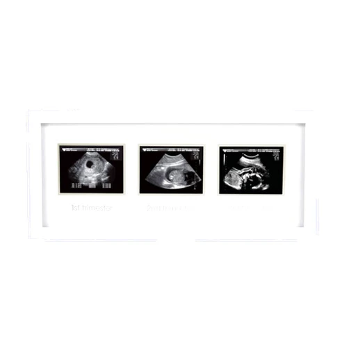 Pearhead Sonogram Progression Frame - Trimester by Trimester Pregnancy Milestone Keepsake, Gender-Neutral Nursery Decor, Displays 1st, 2nd & 3rd Trimester Ultrasound Photos, White