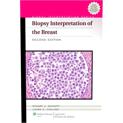 M.D. Schnitt, Stuart, J.,M.D. Collins, Laura C. Biopsy Interpretation of the Breast (Biopsy Interpretation Series)