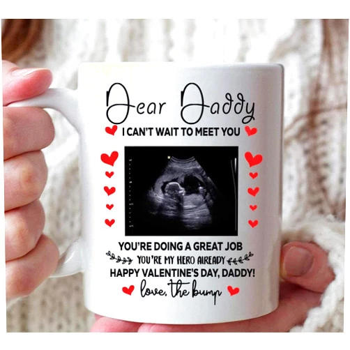 Homelight Personalized Dear Daddy Valentines Day, Baby's Sonogram Picture Mug - I Can't Wait To Meet You, You're Doing A Great Job Mug - Gifts For New First Mom To Be From The Bump,White