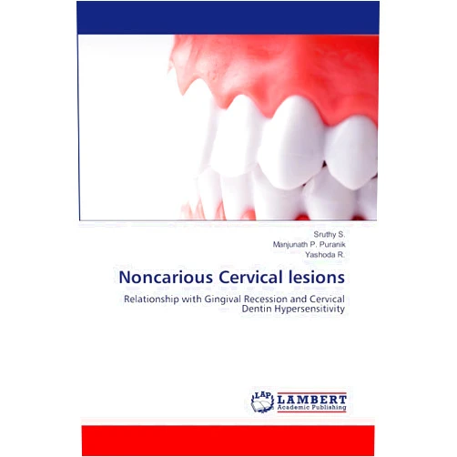 Sruthy S.,Manjunath P. Puranik,Yashoda R. Noncarious Cervical lesions: Relationship with Gingival Recession and Cervical Dentin Hypersensitivity