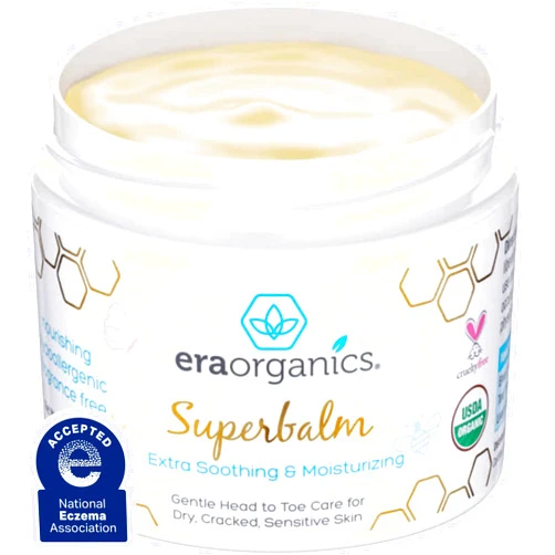 Era Organics Healing Ointment for Babies - USDA Certified Organic Natural Moisturizer Gentle on Sensitive Skin Prone To Baby Eczema, Cradle Cap (Infant Seborrheic Dermatitis), Rashes, Hives and More
