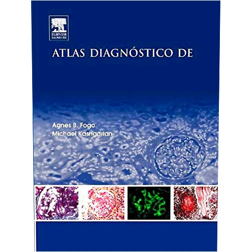 Spanish Edition by Agnes B. Fogo MD (Author), Michael Kashgarian MD (Author) Atlas diagnóstico de patología renal (Spanish Edition)