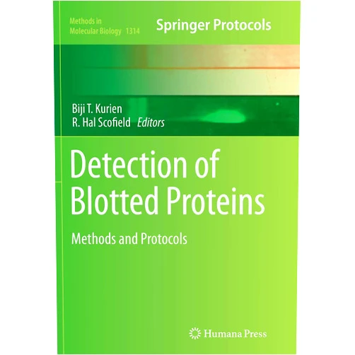 Biji T. Kurien,R. Hal Scofield Detection of Blotted Proteins: Methods and Protocols (Methods in Molecular Biology, 1314)