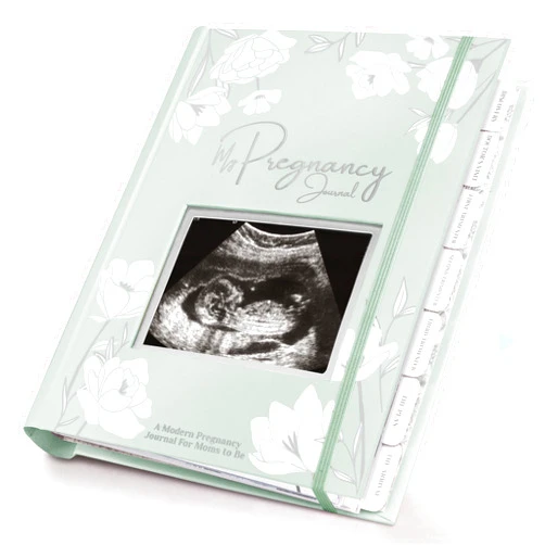 KeaBabies Pregnancy Journal, Pregnancy Announcements - 80 Pages Hard Cover Pregnancy Book For Mom To Be Gift - Pregnancy Gifts For New Moms - First Time Expecting Mom Gift - Baby Memory Book (Sage)