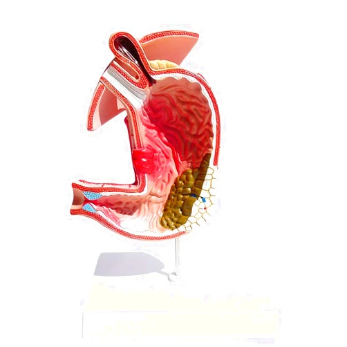 T7anpmmazz Stomach Anatomy Model Gastric Diseases Demonstration Human Digestive System Medical Teaching Anatomical Model