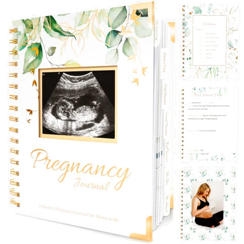 KeaBabies Pregnancy Journal Memory Book - 90 Pages Hardcover Pregnancy Book, Pregnancy Planner, Pregnancy Journals for First Time Moms, Baby Memory Book, Mom Book Diary, Ultrasound Baby Book Memory (Alpine)