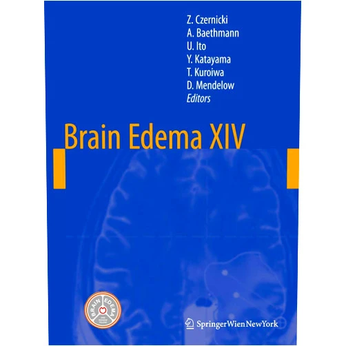 By Zbigniew Czernicki (Editor), Alexander Baethmann (Editor), Umeo Ito (Editor), Yoichi Katayama (Editor), Toshihiko Kuroiwa (Editor), Alexander David Mendelow (Editor) & 2 more Brain Edema XIV (Acta Neurochirurgica Supplement, 106)