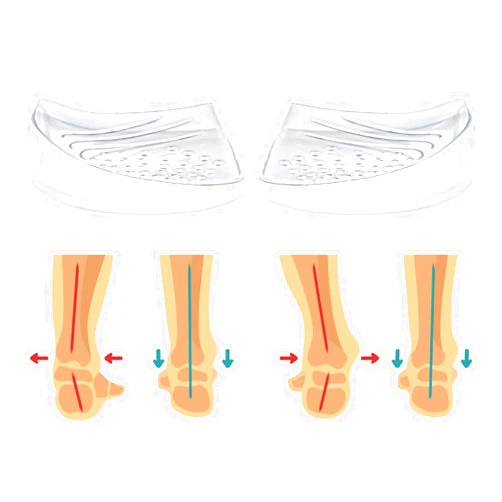 Skyfoot Heel Wedge Inserts for Supination & Pronation Correction, Adhesive Medial & Lateral Heel Insoles for Bow Legs, Knee Pain, Foot Alignment (L: W 8-12 | M 7.5-14, Crystal - 1 Layer)